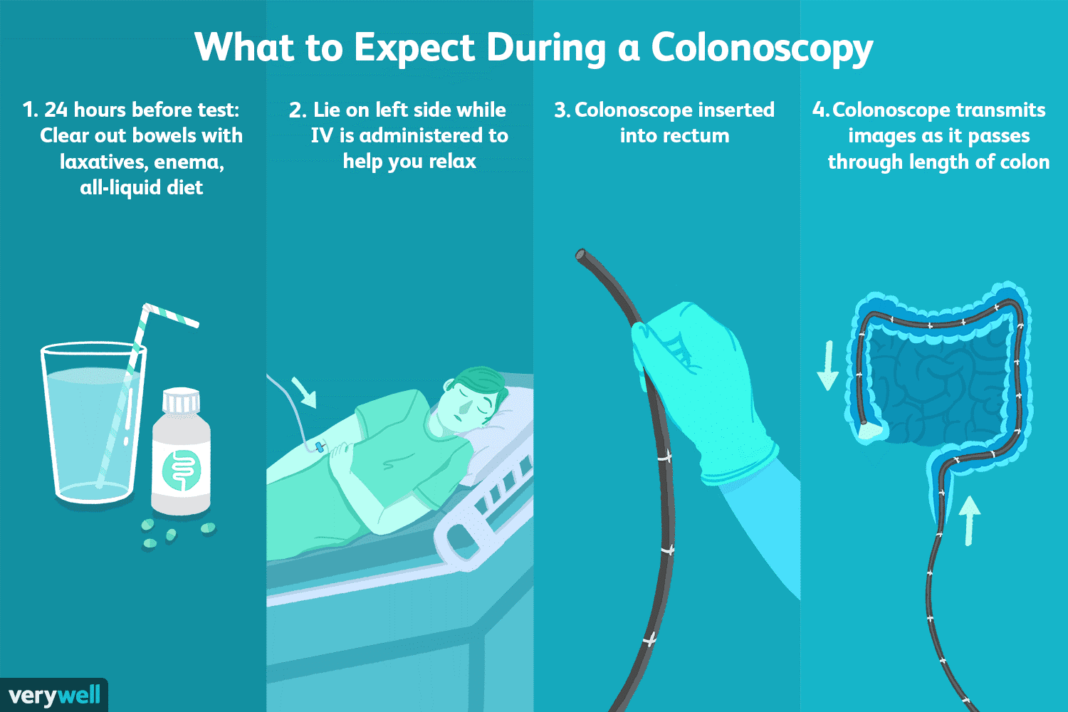 Optimizing Your Preventive Care: The Ideal Frequency For Colonoscopies