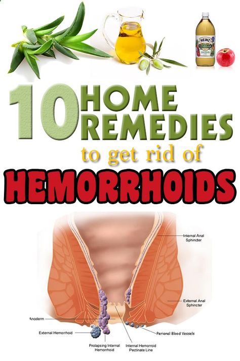 Natural Remedies For Hemorrhoid Removal: How To Get Rid Of Hemorrhoids Fast