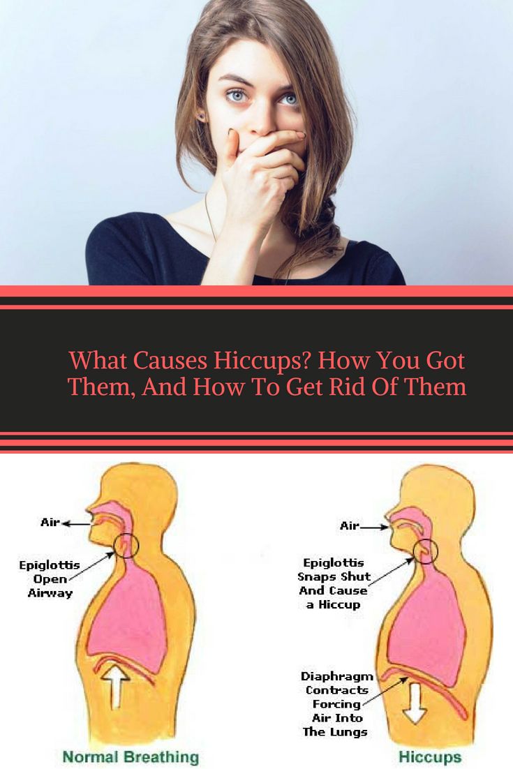 10 Proven Ways To Quickly Get Rid Of Hiccups - Say Goodbye To Annoying Hiccups!